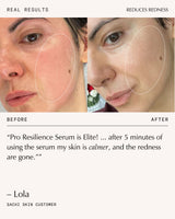 Peptide Pro Resilience® Serum Concentrate - 30ml