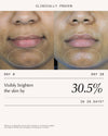 Triphala Pigmentation Corrector - 30ml