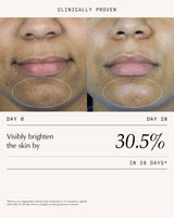 Triphala Pigmentation Corrector - 30ml