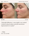 Peptide Pro Resilience® Serum Concentrate - 30ml