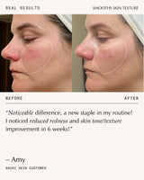 Peptide Pro Resilience® Serum Concentrate Duo
