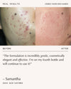 Triphala Pigmentation Corrector - 30ml
