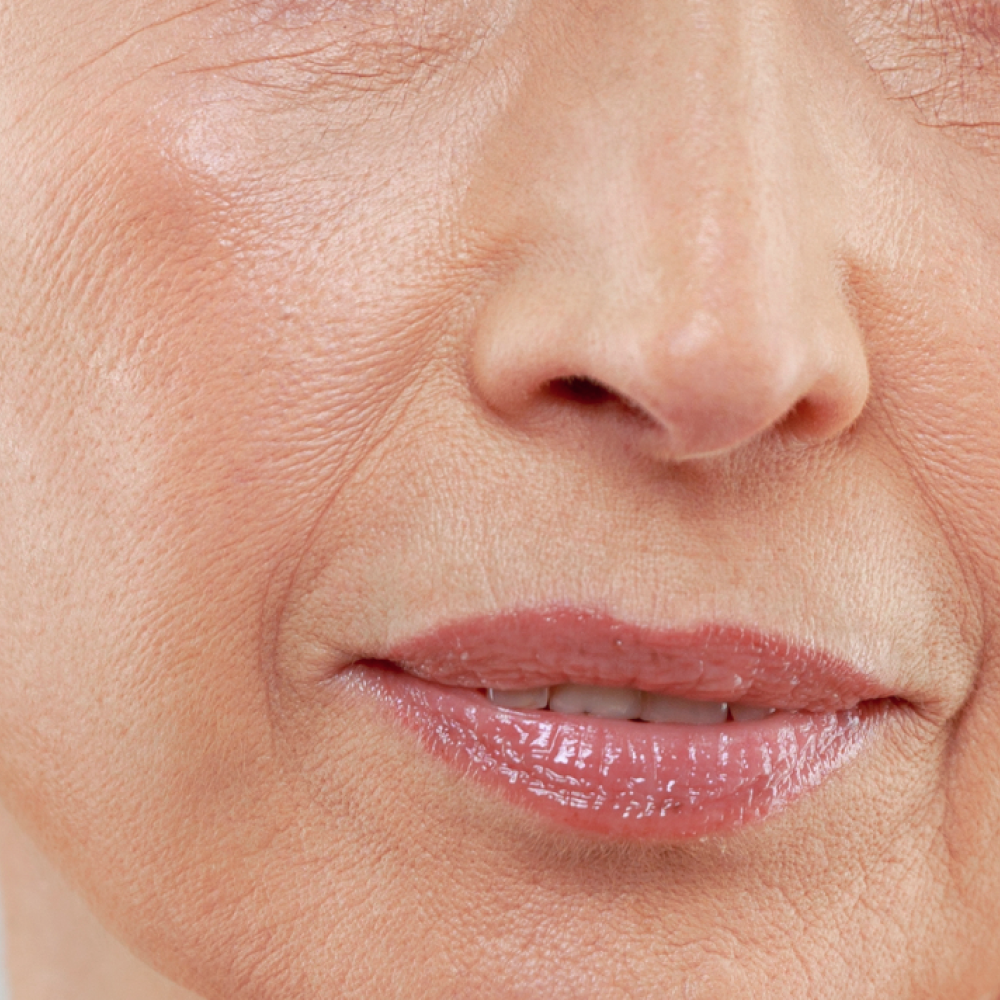 Advanced ageing